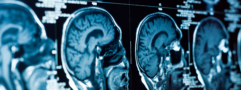 RNSH Neurology Department