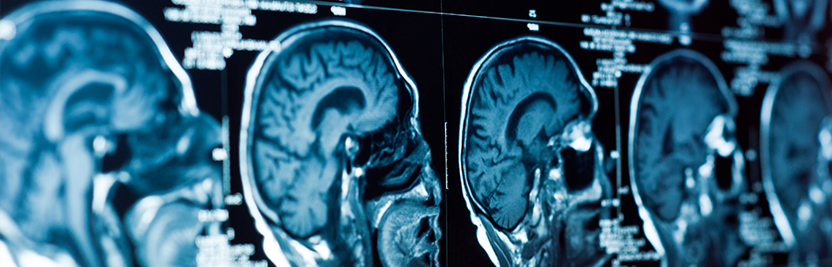 RNSH Neurology Department
